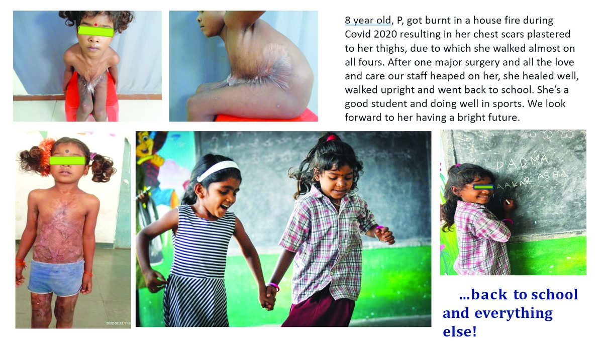 Reconstructive surgery support restoring dignity